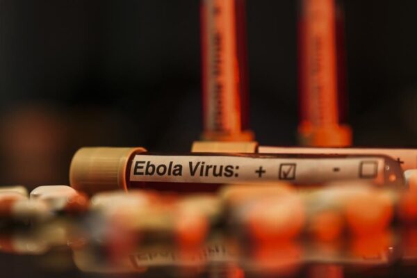 Ebola alarmı: Vaka sayısı 7 bini aştı Ebola alarmı: Vaka sayısı 7 bini aştı